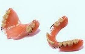 Имплантация зубов: какие у нас преимущества?